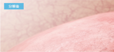 分解後のイメージ