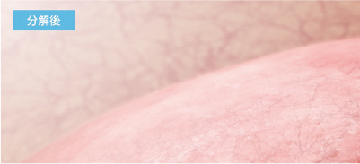 分解後のイメージ